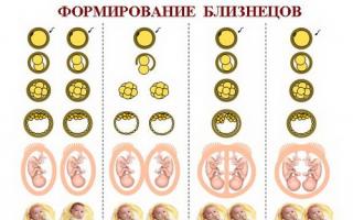 Двойняшки беременность: причины, признаки, роды и протекание беременности Рождение двойни на 36 недели беременности